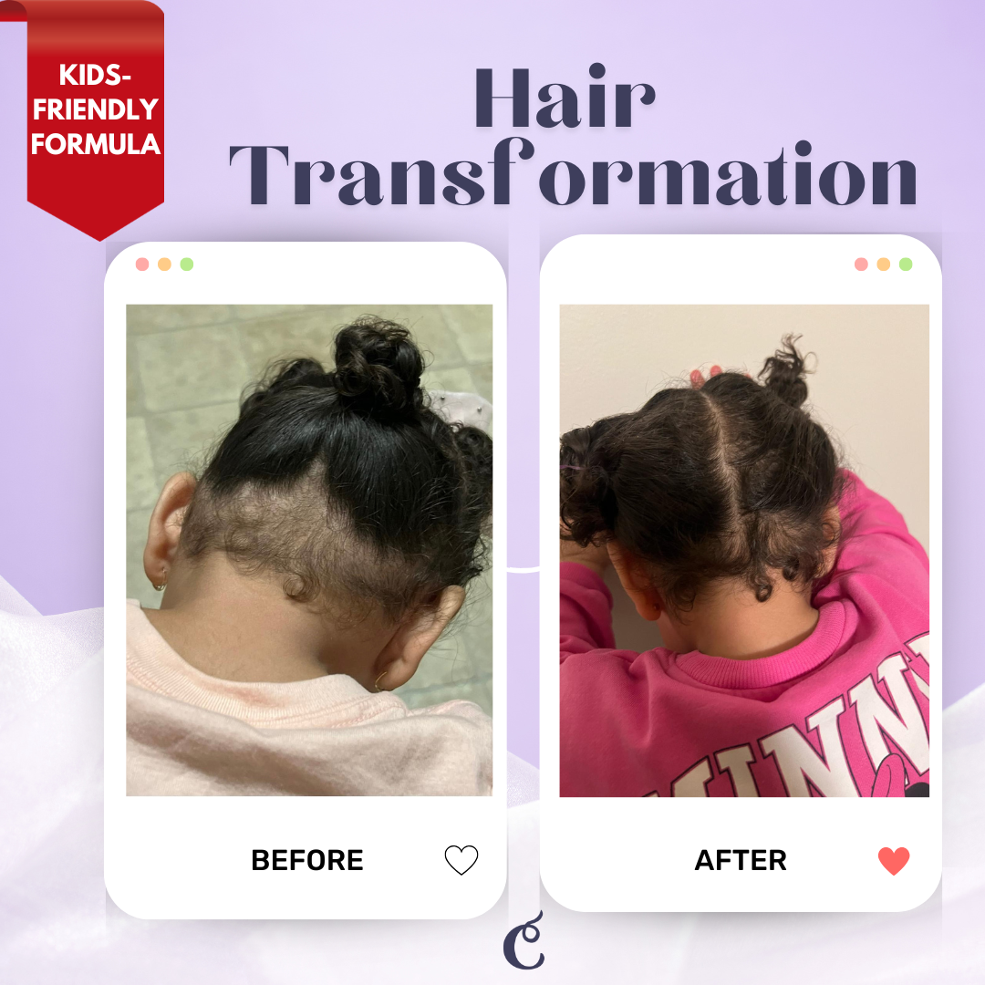 Premium Rosemary & Lavender Hair Growth Oil | Stimulates Growth & Thickness